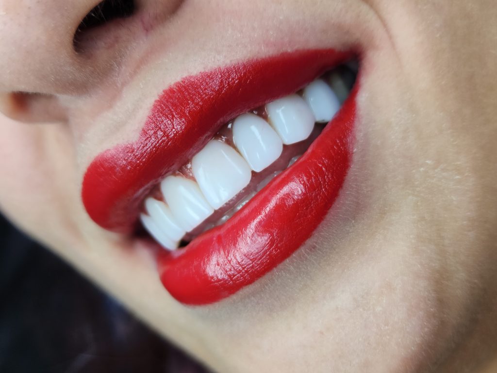 بهترین برند های کامپوزیت دندان: کلینیک دندانپزشکی دیبا
