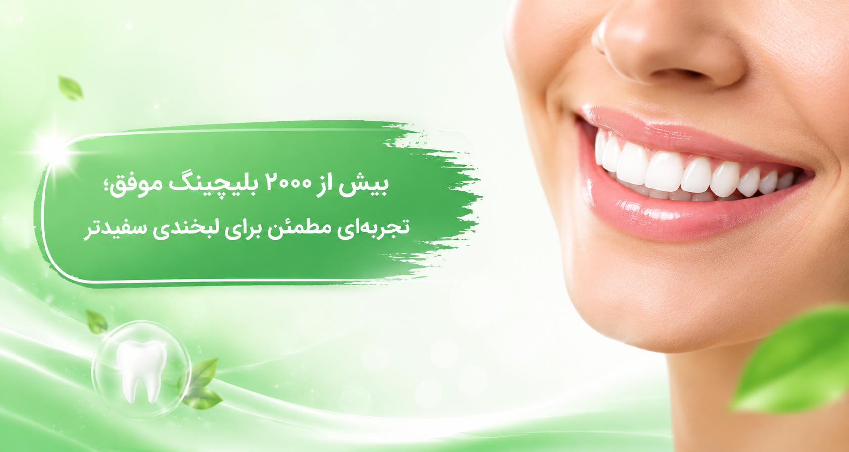 بلیچینگ