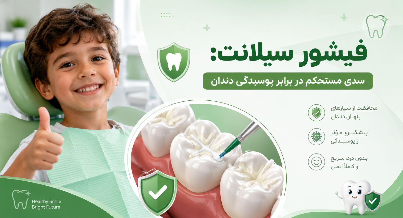 فیشور سیلانت