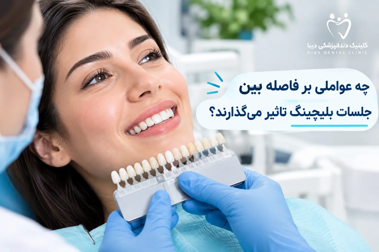 فاصله بین جلسات بلیچینگ