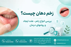 زخم دهان چیست؟ بررسی انواع زخم، علت ایجاد و روشهای درمان