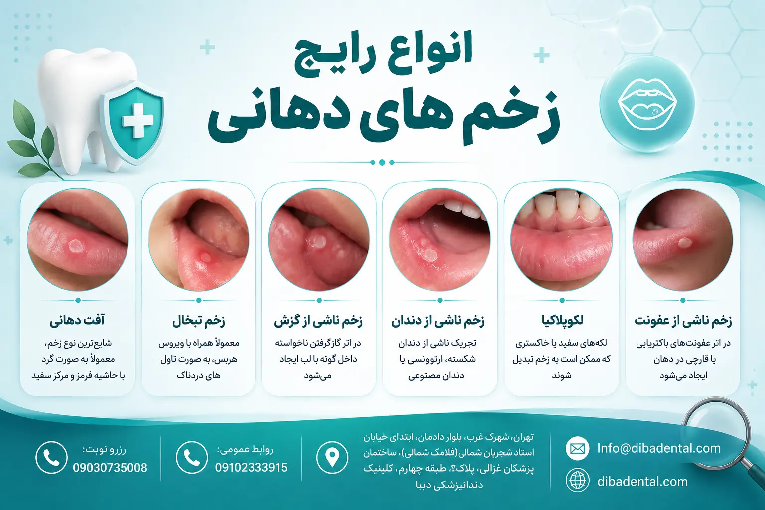 زخم دهان چیست؟ علل، انواع و بهترین راهکارهای درمان سریع
