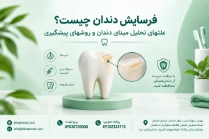 فرسایش دندان چیست؟ علتهای تحلیل مینای دندان و روشهای پیشگیری