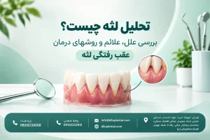 تحلیل لثه چیست؟ بررسی علل، علائم و روشهای درمان عقب رفتگی لثه