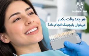 هرچند وقت یکبار میتوان بلیچینگ انجام داد؟