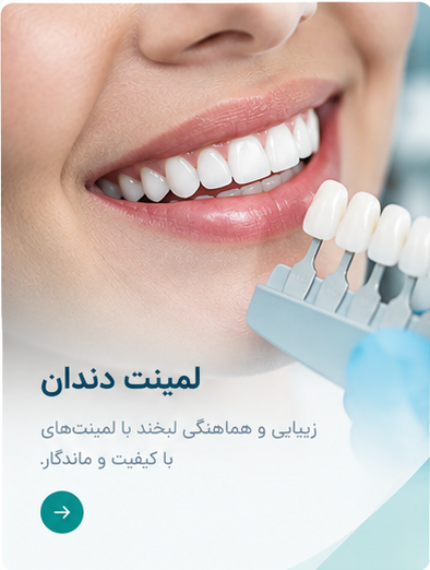 خدمات لمینت دندان