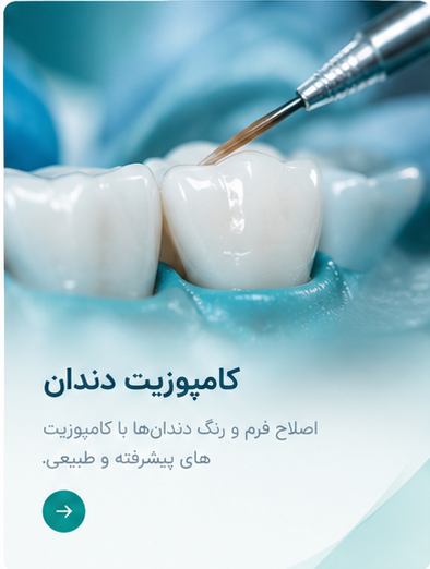 خدمات کامپوزیت دندان