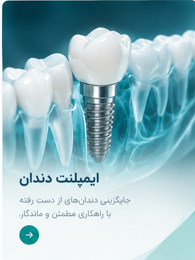 خدمات ایمپلنت دندان