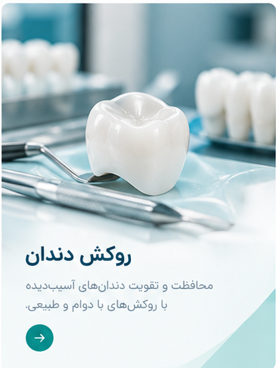 خدمات روکش دندان