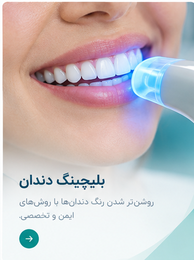 خدمات بلیچینگ دندان
