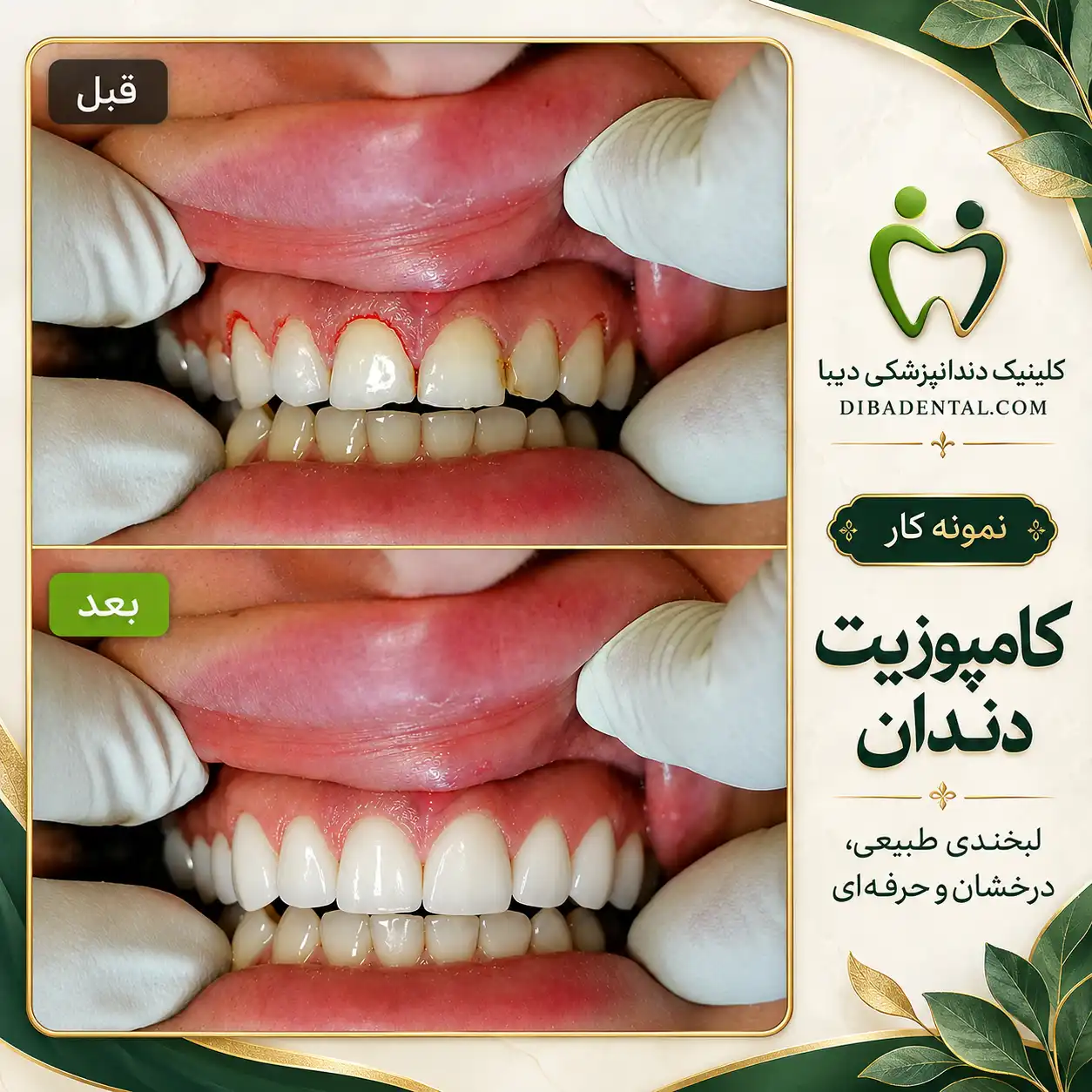 نمونه‌کار دیبا دنتال