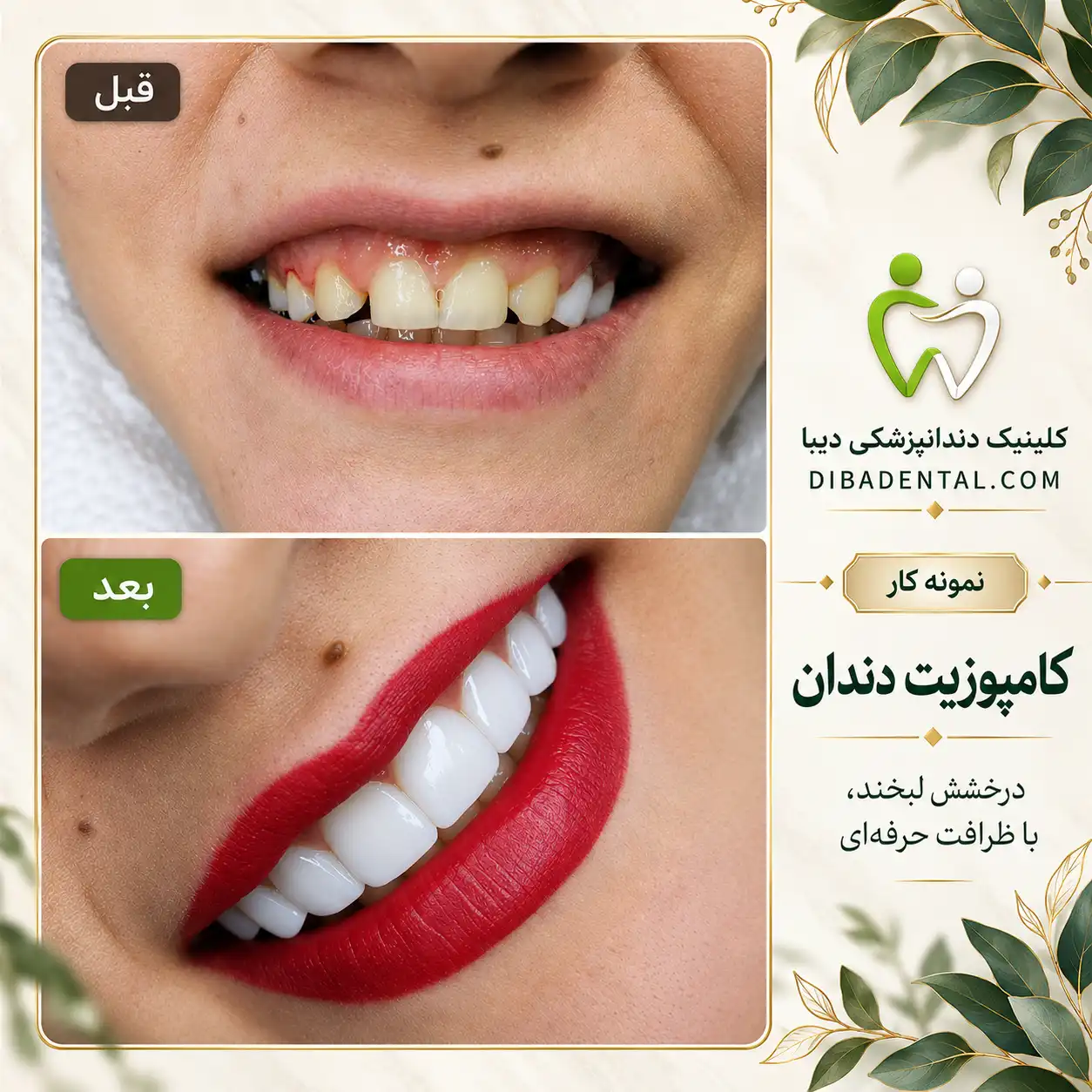 نمونه‌کار دیبا دنتال