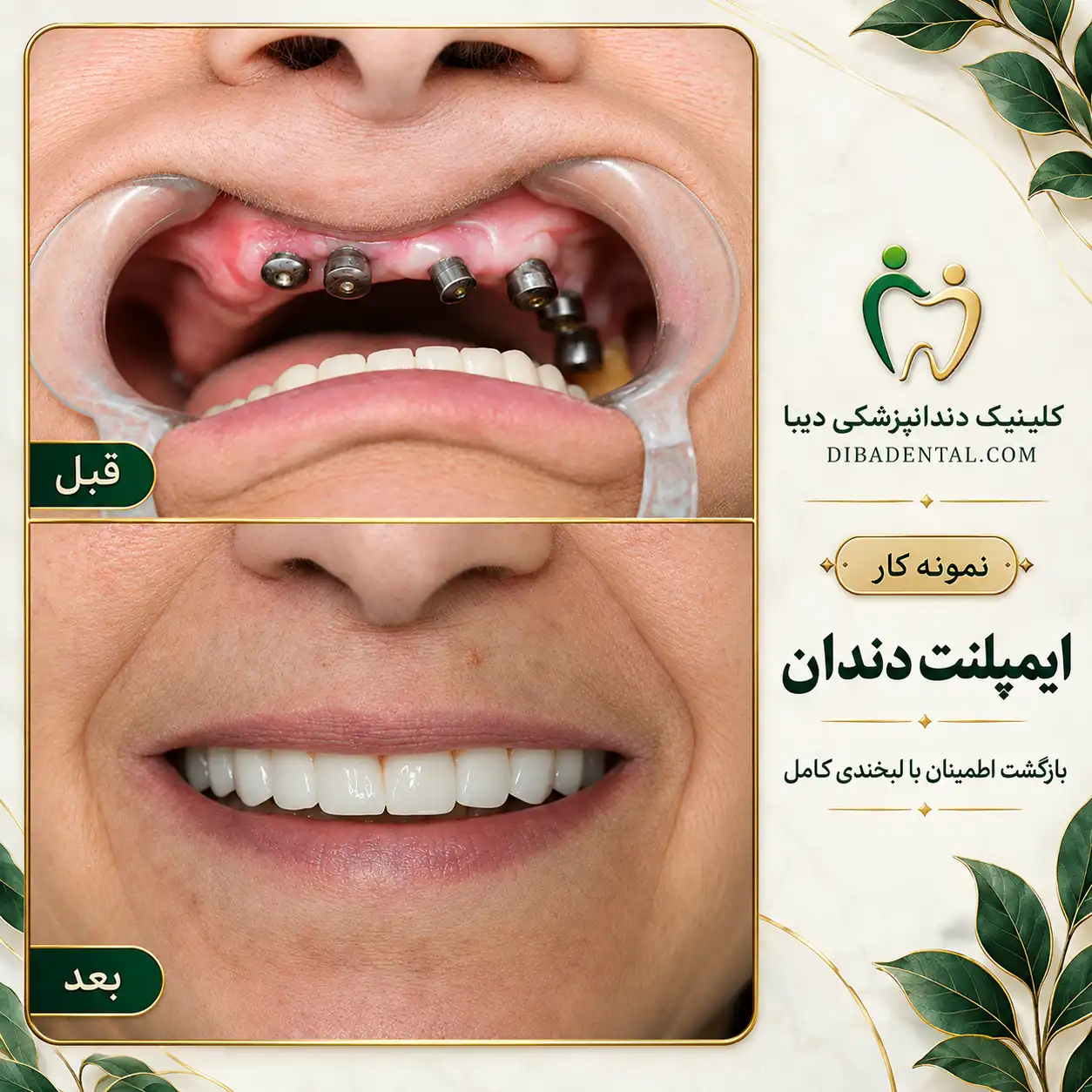 نمونه‌کار دیبا دنتال