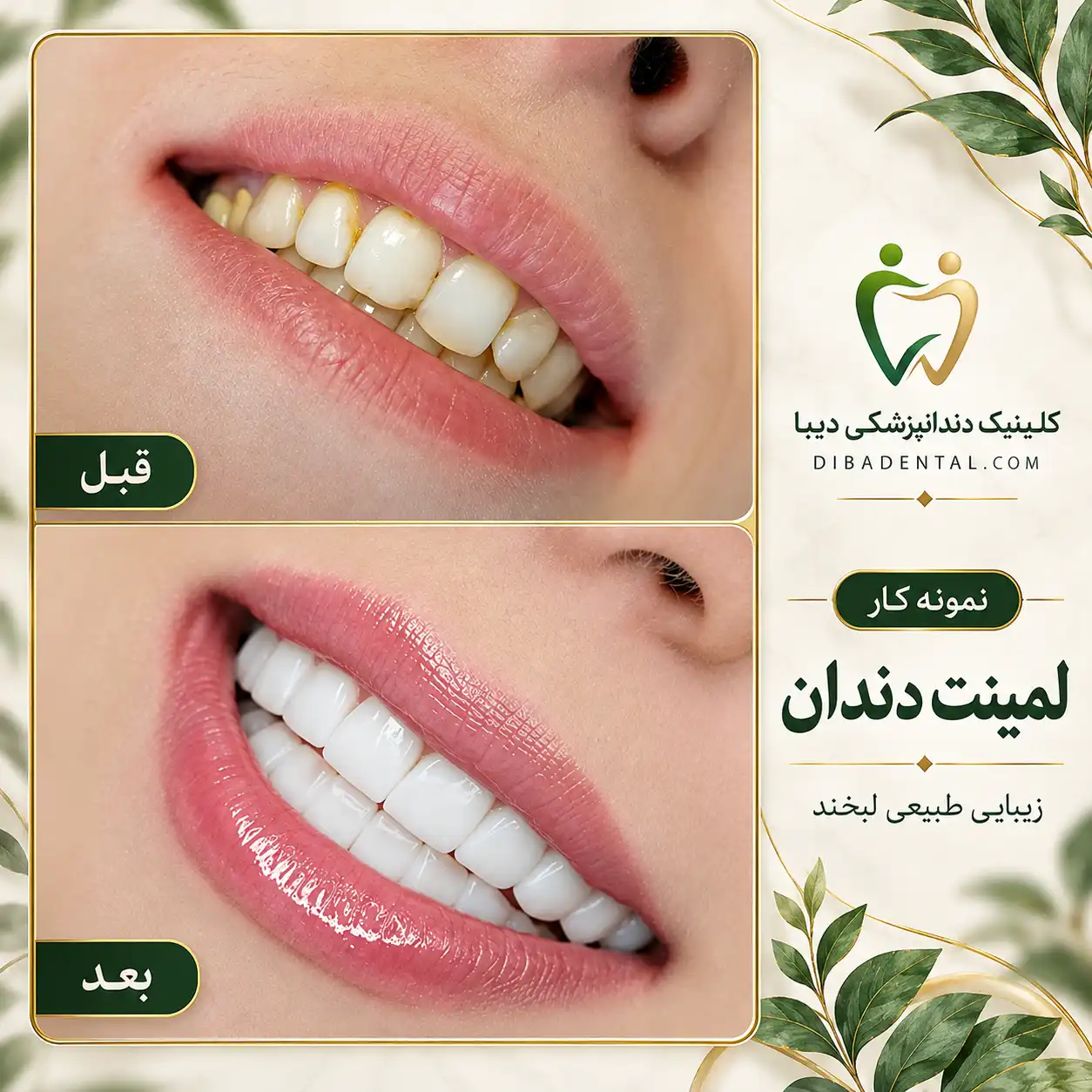 نمونه‌کار دیبا دنتال