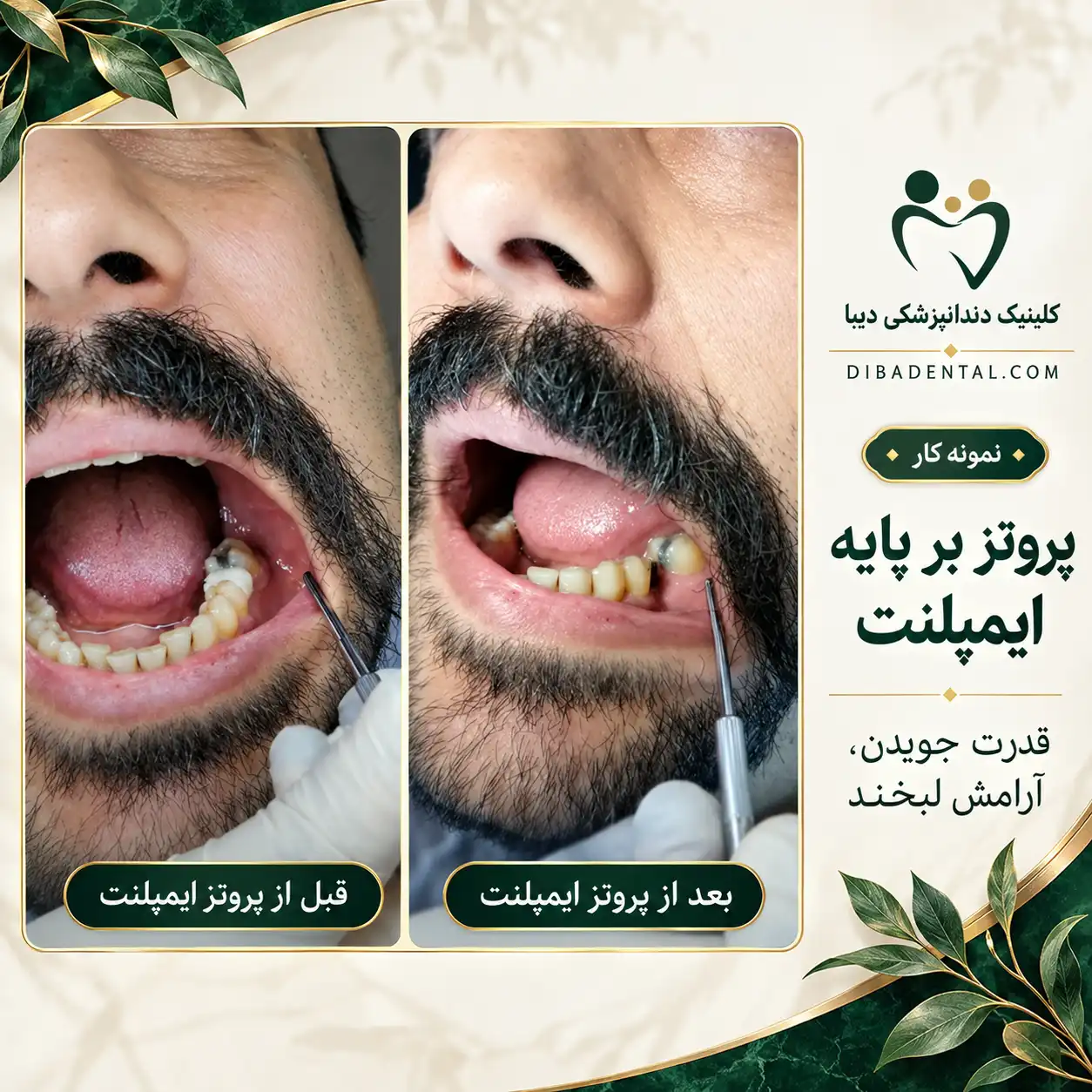 نمونه‌کار دیبا دنتال