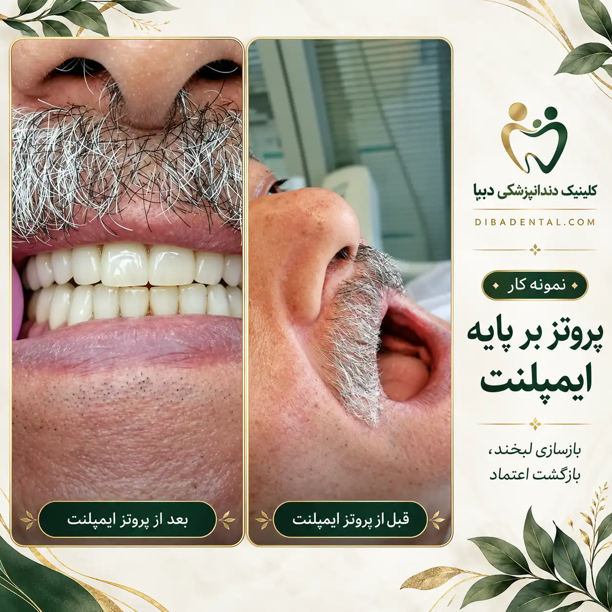 نمونه‌کار دیبا دنتال